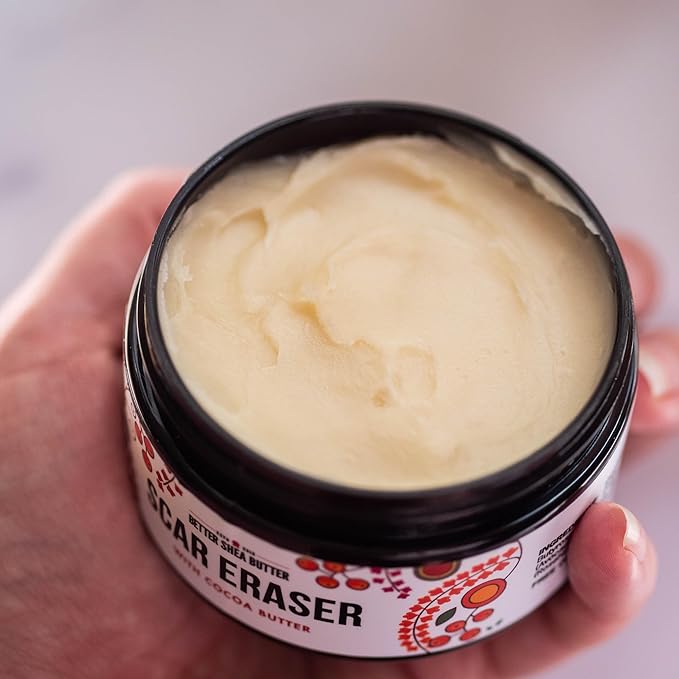 Better Shea Butter Scar Eraser Balm - Cocoa Butter Cream for Stretch Marks and Dark Spots, Burns, Old Scars - Acne Scars - Designed w Zero Synthetic Ingredients, 4 oz