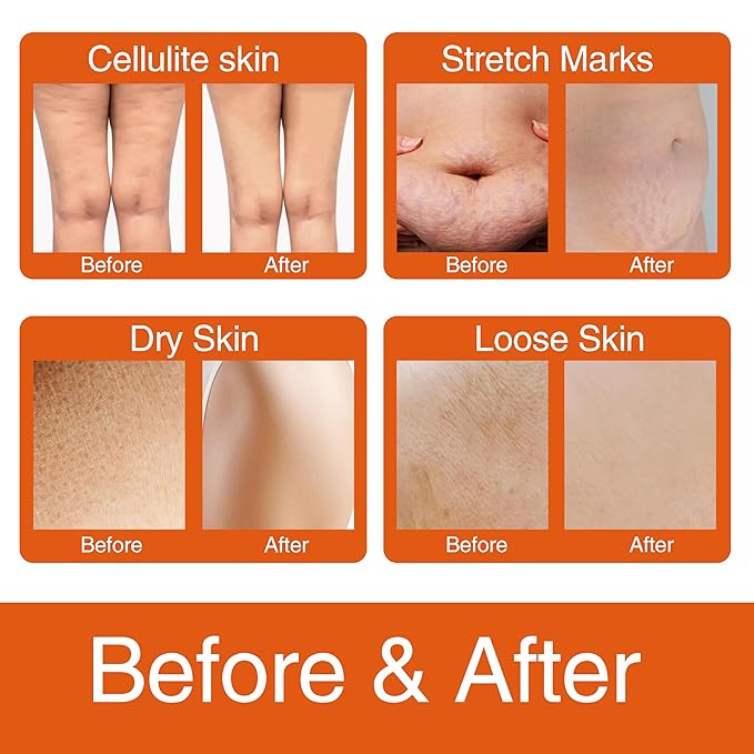 Cellulite Cream for Legs, Belly & Booty: Firming Cream Reduces Cellulite, Fades Stretch Marks, Lifts Sagging Skin, 3.53 Oz | Daily After Shower & Post-Workout, Ideal for Moms