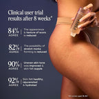 Luna Daily Stretch Mark Body Oil | Hydrating Treatment for Scars, Discoloration & Uneven Skin Texture | Vitamin C & Coconut Oil Nourish Dry Skin | Clinically Proven, Pregnancy Safe for Women, 300ml