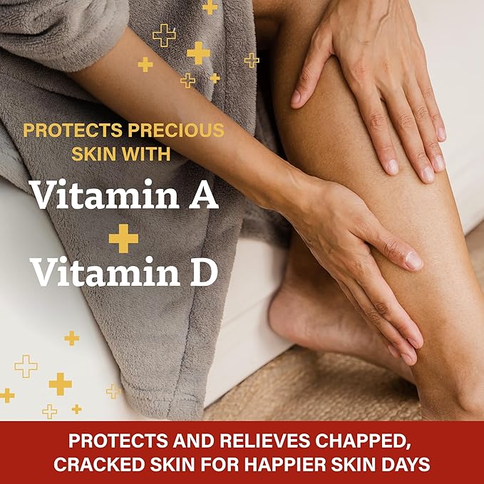 A+D First Aid Multipurpose Healing Ointment - Moisturizing Skin Protectant for Dry Cracked Heels, Elbows, Hands and Lips - Protects Minor Cuts, Burns, & Scrapes – 4 oz Tube