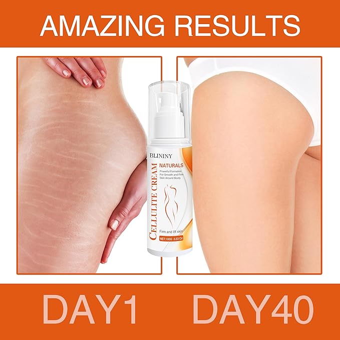 Cellulite Cream for Legs, Belly & Booty: Firming Cream Reduces Cellulite, Fades Stretch Marks, Lifts Sagging Skin, 3.53 Oz | Daily After Shower & Post-Workout, Ideal for Moms