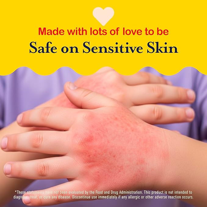 Hypochlorous Acid Spray For Kids - Soothes Diaper Rash, Baby Acne, Eczema, Cuts & Scrapes - Baby & Kids Skin Soothing Spray for Sensitive Skin, Non-Toxic, No Sting, 4 oz